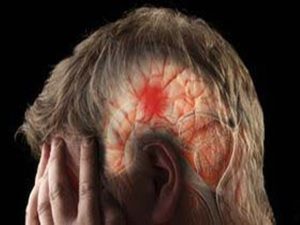 1855834-stroke-1572011615-600x450.webp.webp