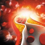 1962426-cholesterol-1579728075-600x450.webp.webp