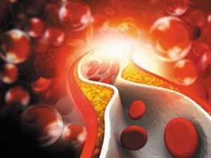 1962426-cholesterol-1579728075-600x450.webp.webp