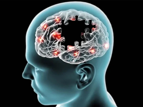 alz1781288484-0-600x450.webp.webp