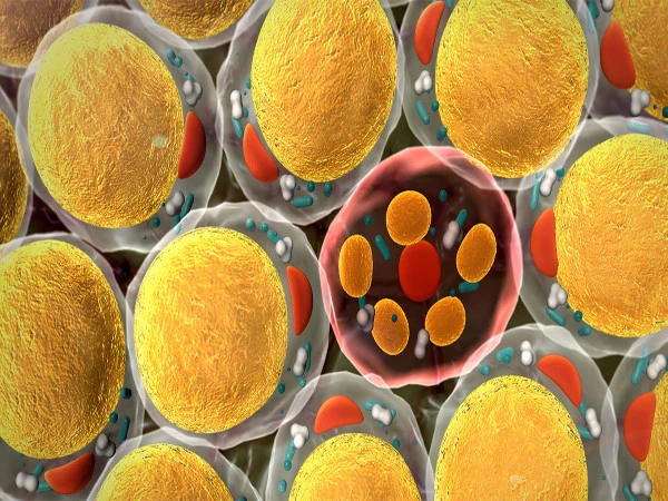 fats1785091615-0-600x450.webp.webp
