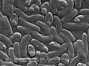 bacteria1786472220-0-600x450.webp.webp