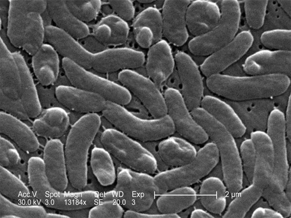 bacteria1786472220-0-600x450.webp.webp