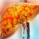 liver1764355884-0-600x450.webp.webp