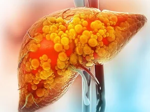 liver1764355884-0-600x450.webp.webp