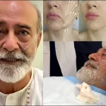 muhammad-ahmed-face-lift1786381080-0-600x450.webp.webp